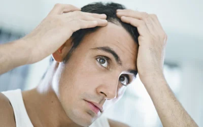 El cabello más abundante comienza aquí.